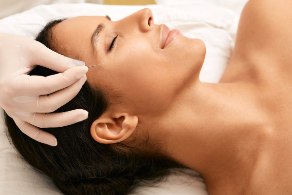 Facial Acupuncture Integrity Centre Liverpool Street